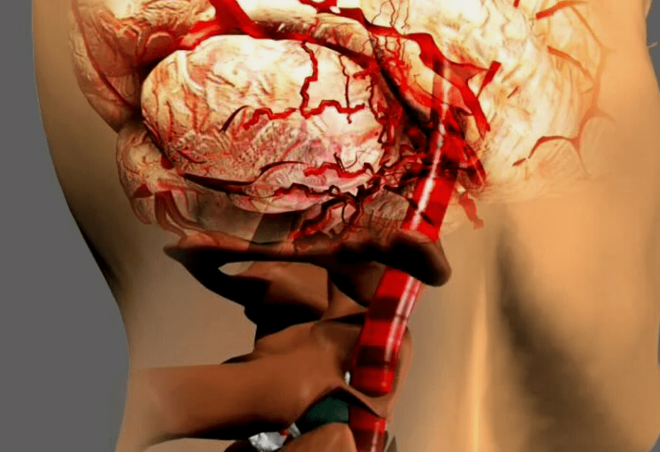 que l'ostéochondose cervicale est dangereuse