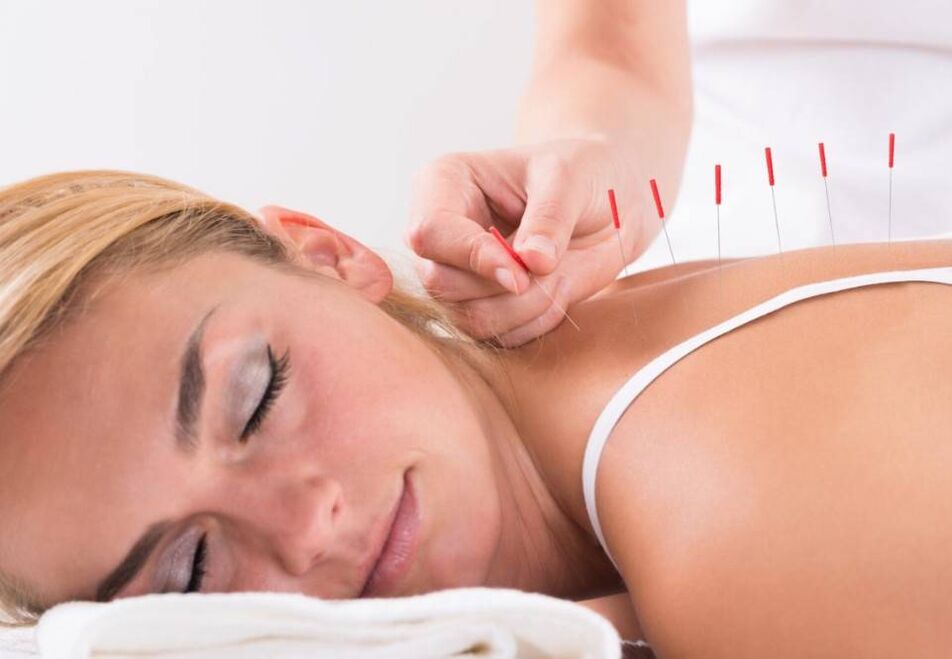 L'acupuncture aidera à soulager la douleur liée à l'ostéochondrose